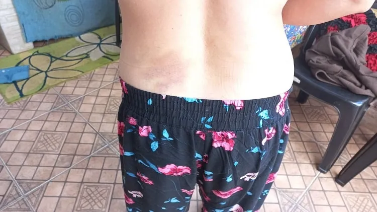 Mulher denuncia agressão policial no bairro Piedade, em Ouro Preto: “Me trataram como um animal”