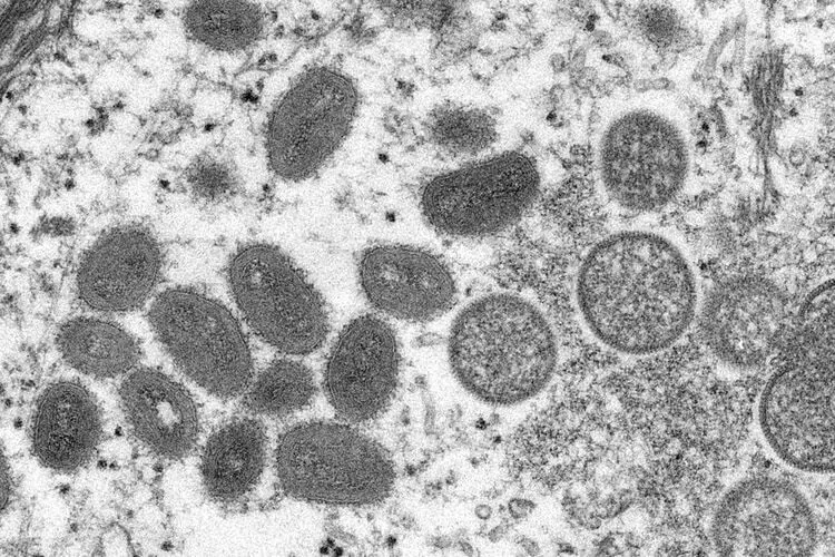 Suspeita de varíola dos macacos em morador de Ouro Preto é descartada